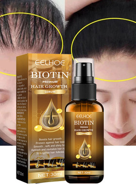 Ginger Hair Fast Growth Serum Spray Biotin Anti Hair Loss
