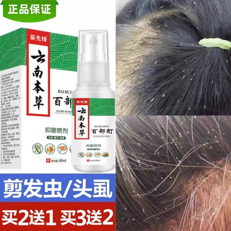 治小孩头上有虱子药去小女孩灭儿童头发里杀长的虫子狮子除阴虱净