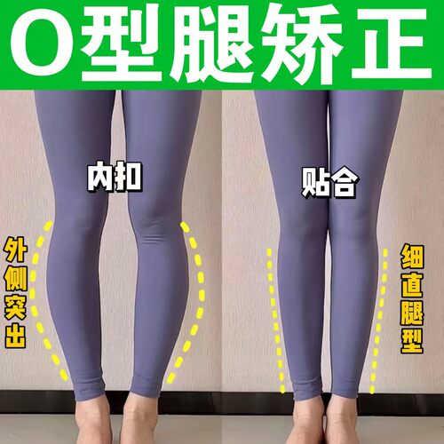 0型腿塑型袜套OX型矫正神器腿贴填充腿袜修饰护膝改善罗圈腿外翻