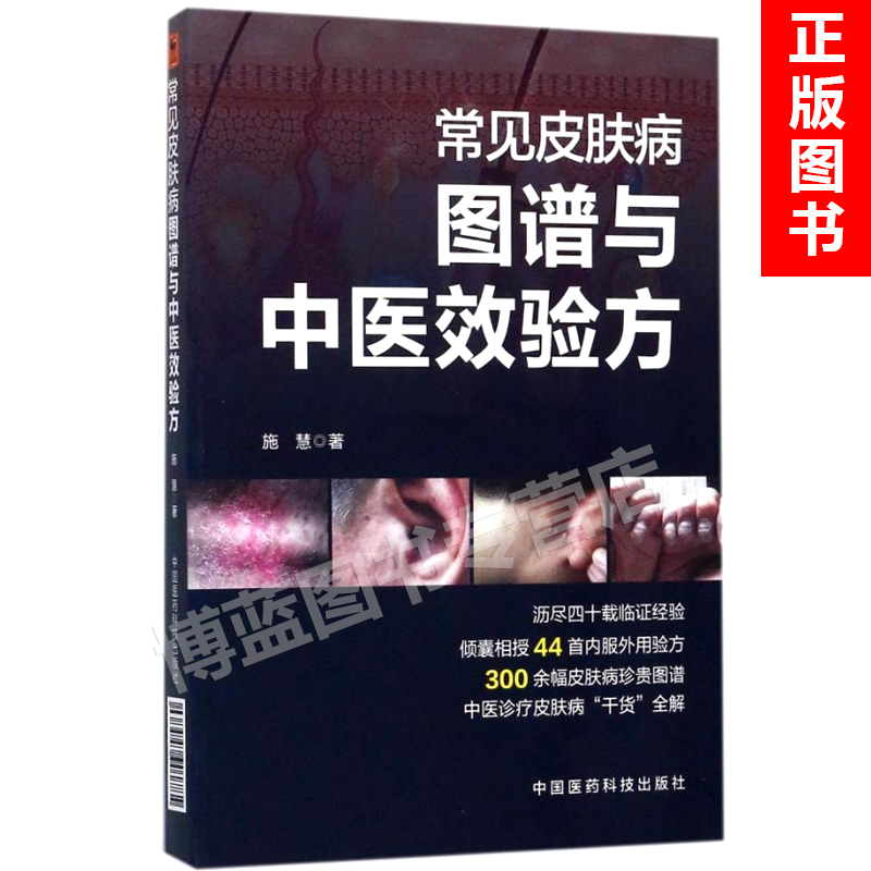 正版常见皮肤病图谱与中医效验方施慧章节之下有痤疮脂溢性皮炎带状疱疹银屑病等常见皮肤病具辨识度的图片等中国医药科技出版社 书籍/杂志/报纸 医学图谱 原图主图