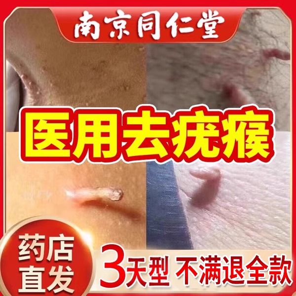 扁平疣瘊子去除软膏一抹灵脖子上长小肉粒疙瘩腋下丝状疣去除神wp
