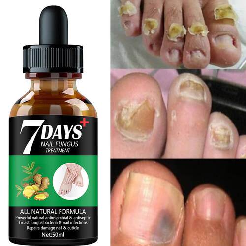 Nail Fungus Treatment Essence Serum Care Hand and Foot Care