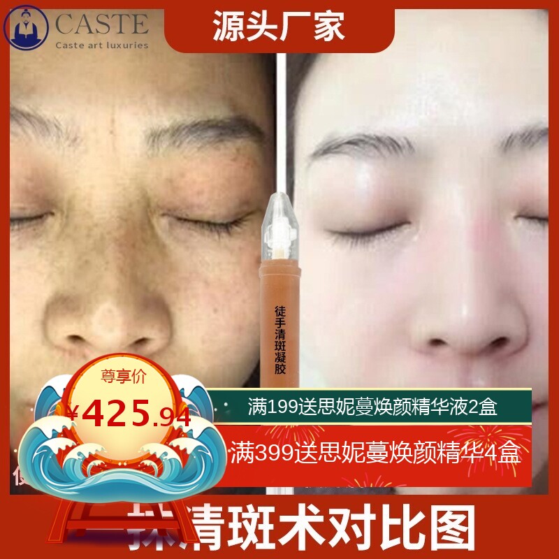 祛斑精华液不脱皮无需修复美肤液美容院线下专用不挂网护肤品套盒