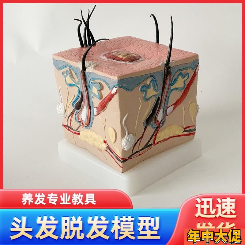 人体毛发脱发模型头发头皮发炎毛细血管毛囊收缩教学教具演示模型