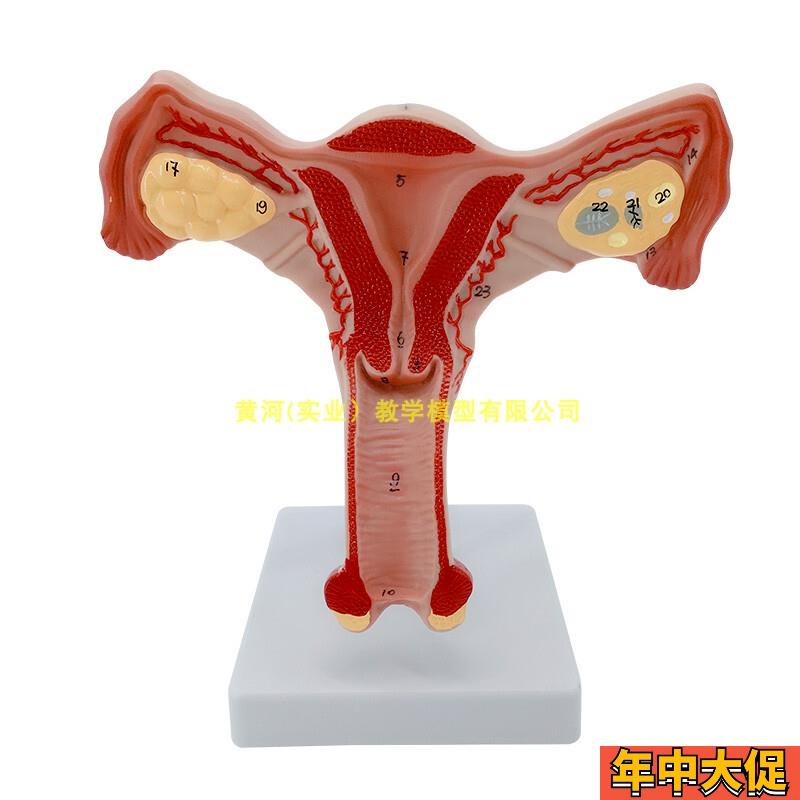 人体子宫卵巢阴道 女性内外生殖器官解剖模型 生殖科妇科演示模型