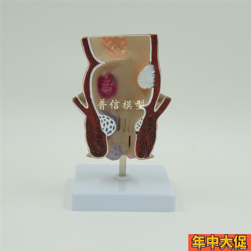 普信仿真人体直肠结肠演示模型 教用医用肛肠科教学沟通用具解剖