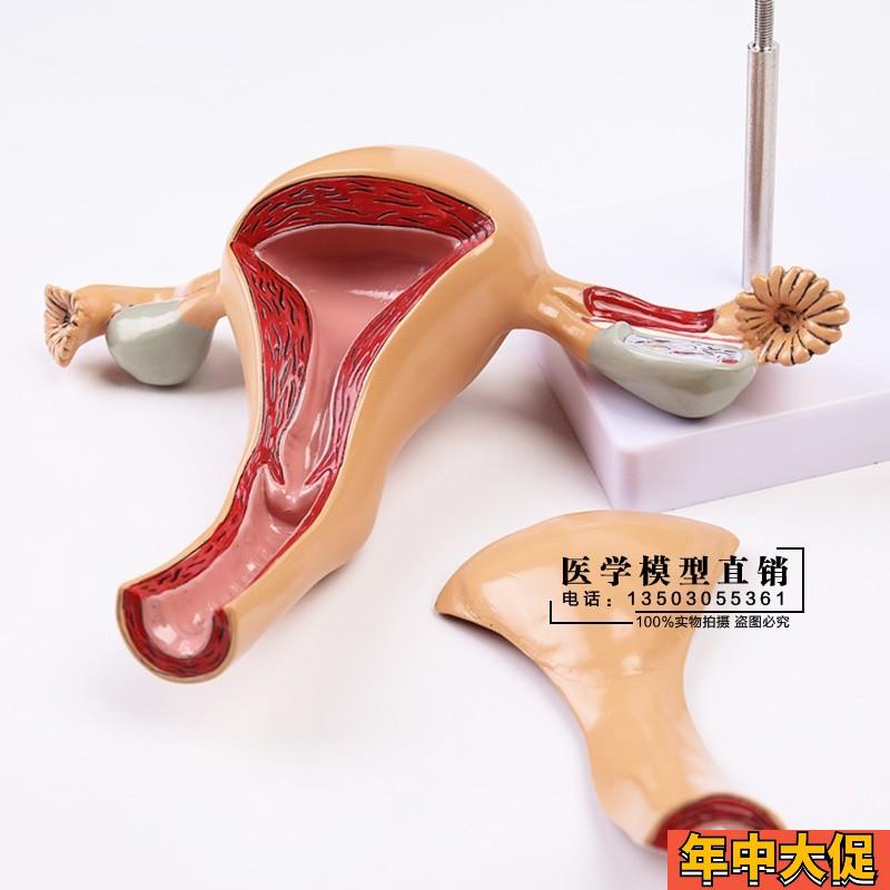 医用女性内生殖器官解剖模型 子宫卵巢生殖结构妇科模型 子宫教具