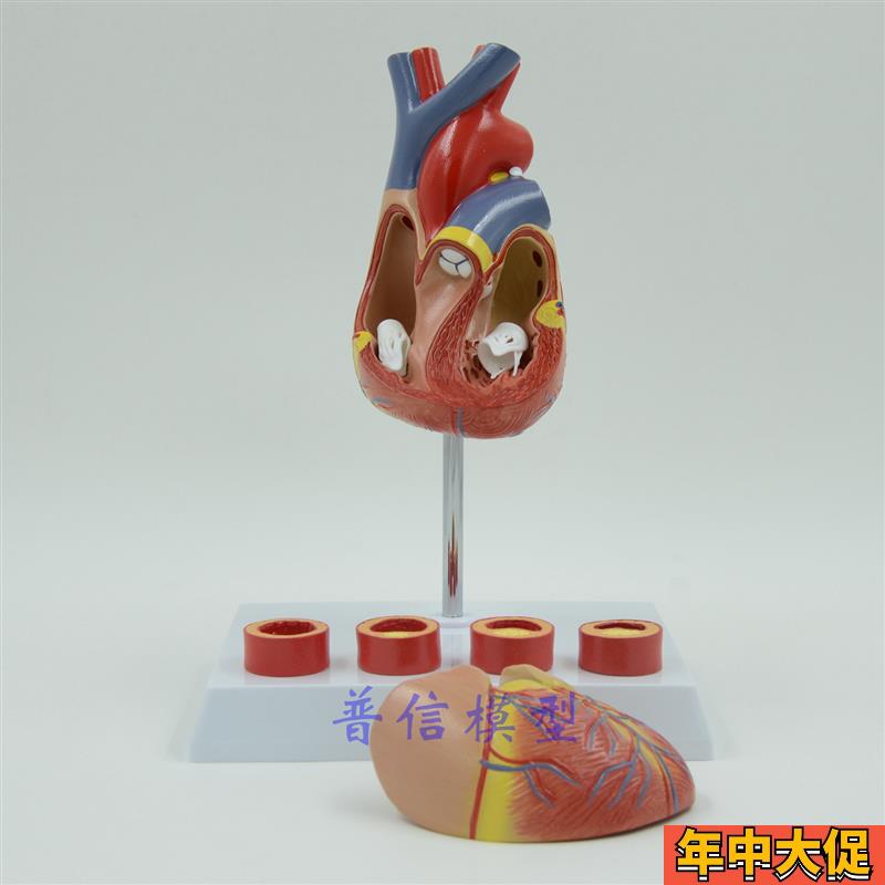 普信 豪华心脏模型 带4阶段血管 教学医用 心脏解剖模型 心血管