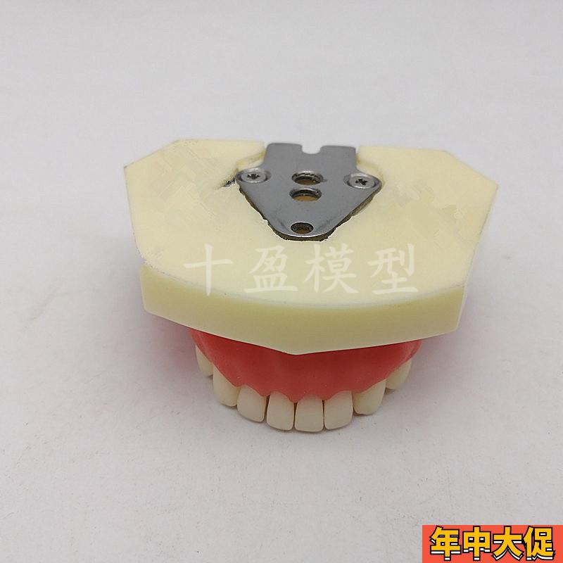 牙科口腔种植练习模型 学生练习切开缝合种植模型 下颌种植2029下
