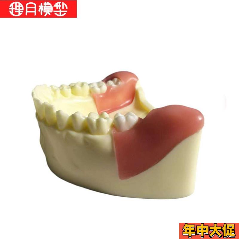 牙科材料种植练习模型上颌窦口腔模具培训班教学专用模型牙齿牙模