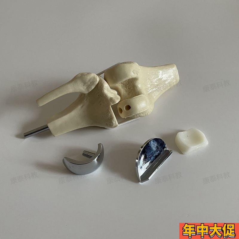 人工膝关节模型膝盖置换仿真假体半月板软骨胫骨平台髋关节替换术