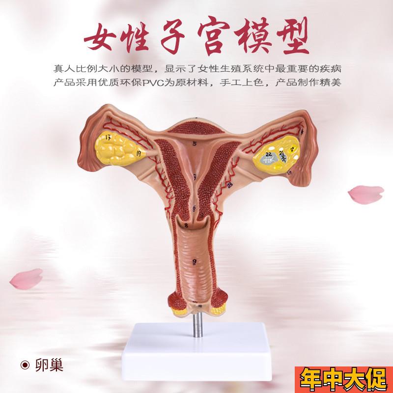 人体子宫解剖模型 女性生殖系统计生教育演示器材 厂家直销