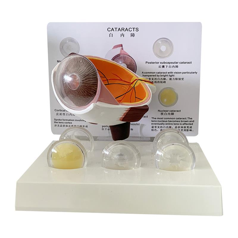 眼睛模型 晶片虹膜器官解剖白内障光学教仪医用医学教学教具