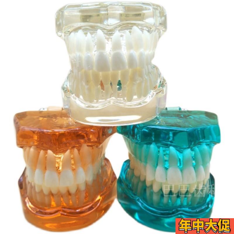 牙科口腔模型 标准牙齿模型 标准牙列牙脊线清晰四种对比托槽模型