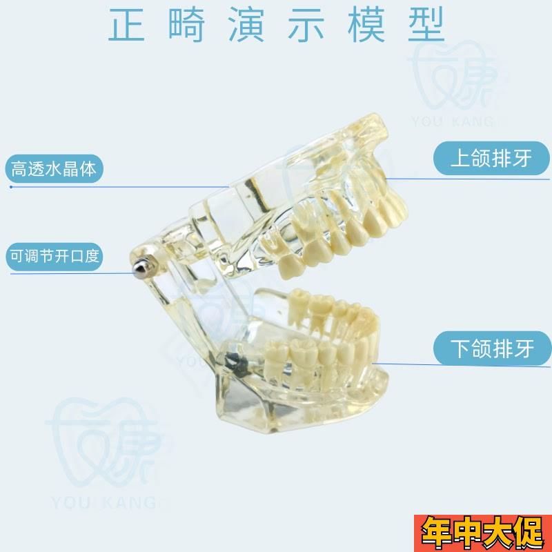 牙齿模型病理修复可拆卸正畸口腔病理牙模型牙科医患活动沟通