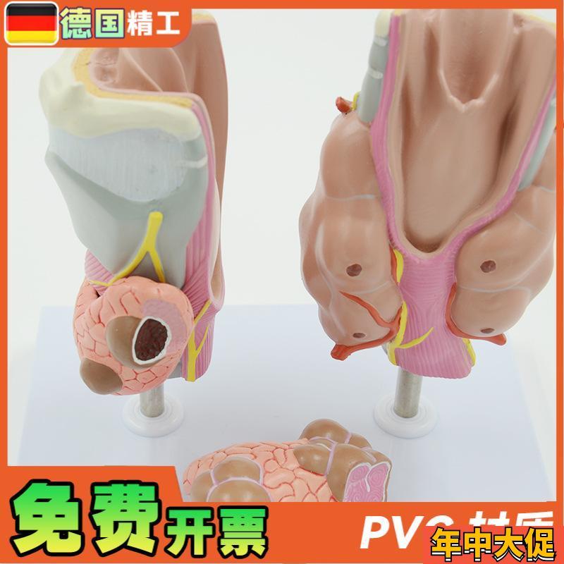 德国】甲状腺病理模型喉头解剖模型 教学用解剖甲状腺病理模具