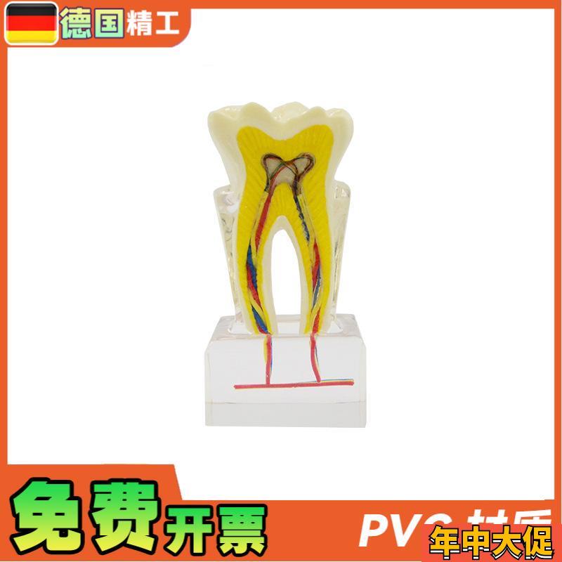 德国】PNT-OR12口腔教学模型牙科6倍牙神经模型 牙齿构造展示放大
