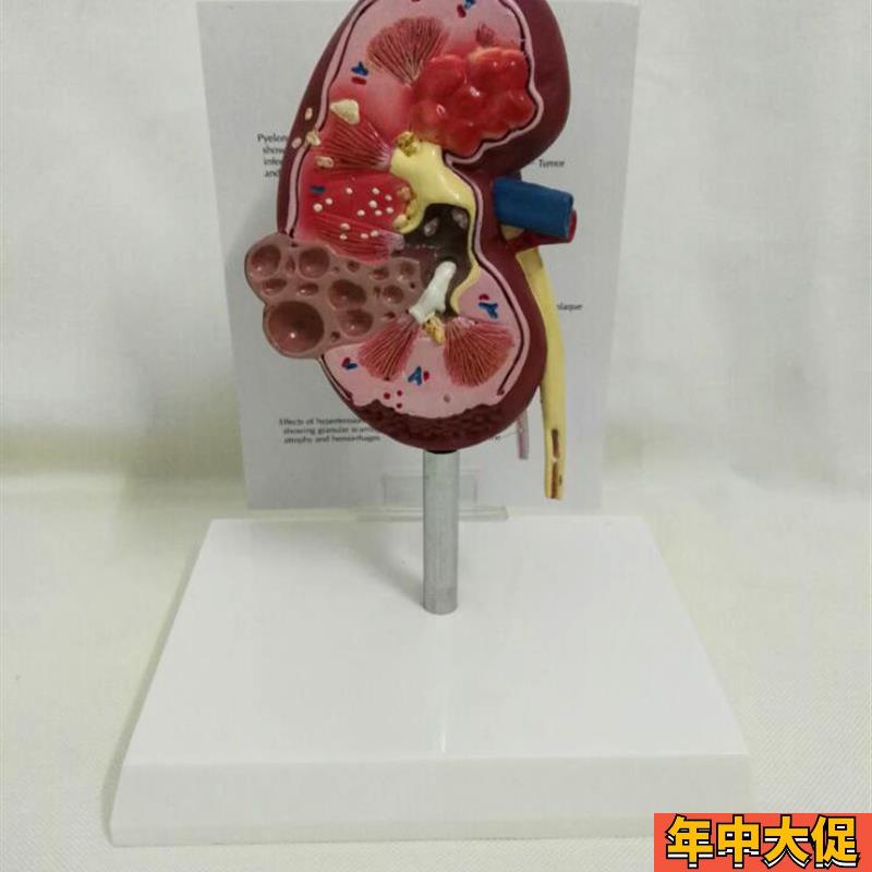 狗肾脏病态健康解剖模型犬肾脏解剖模型宠物教学教具医学教仪模型