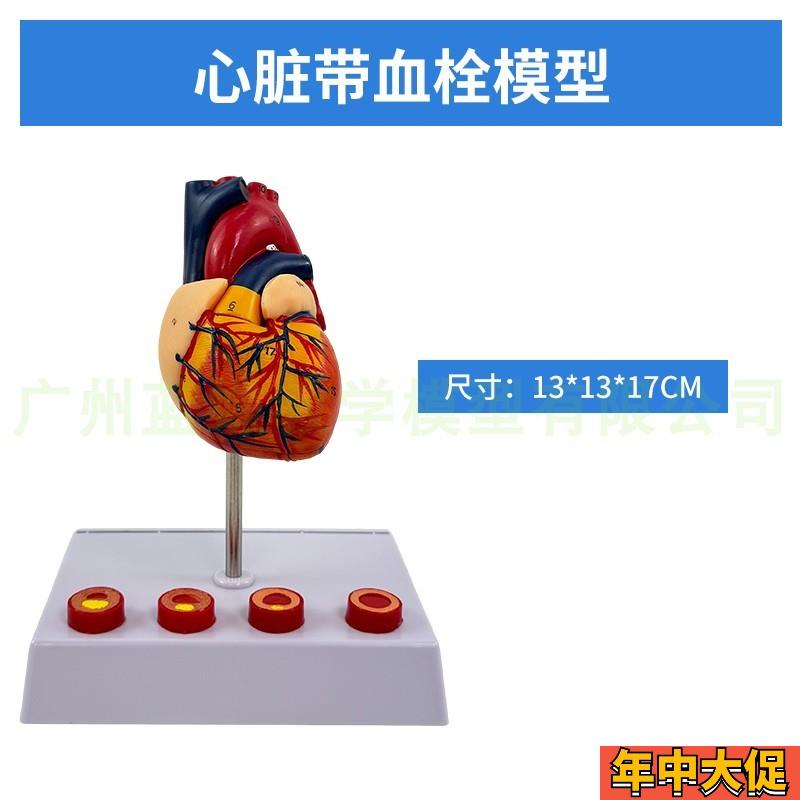 蓝蝶正品 医学人体心脏解剖模型 B超彩超心脏标本心血管内科模型