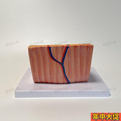 康泰医学模型胃壁层次放大浆膜医药消化科展示胃解剖放大肌层血管