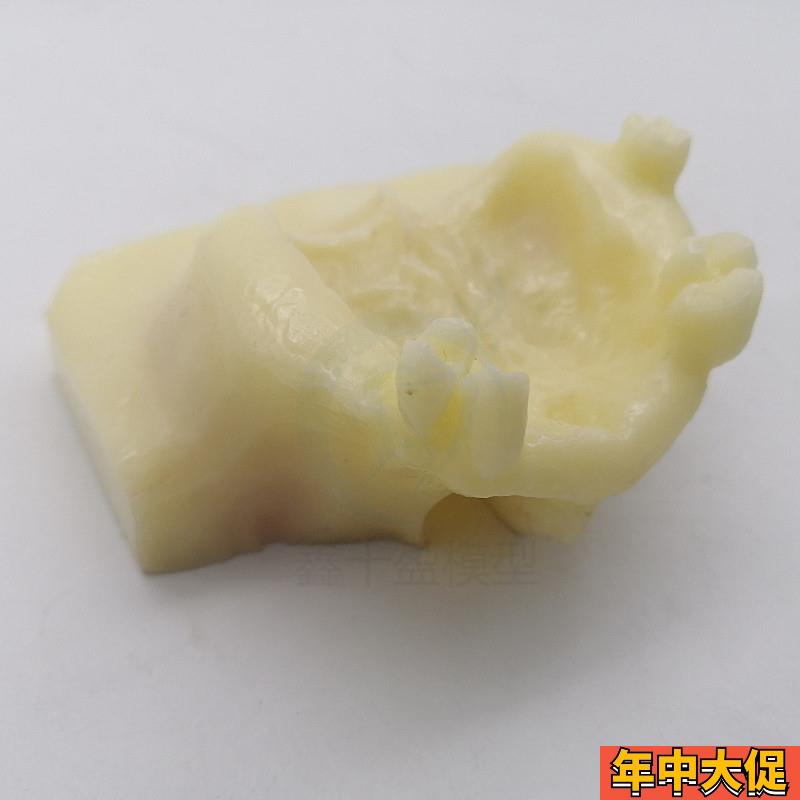 牙科口腔教学模型 上颌窦提升术练习模型 种植练习实训操作 实操