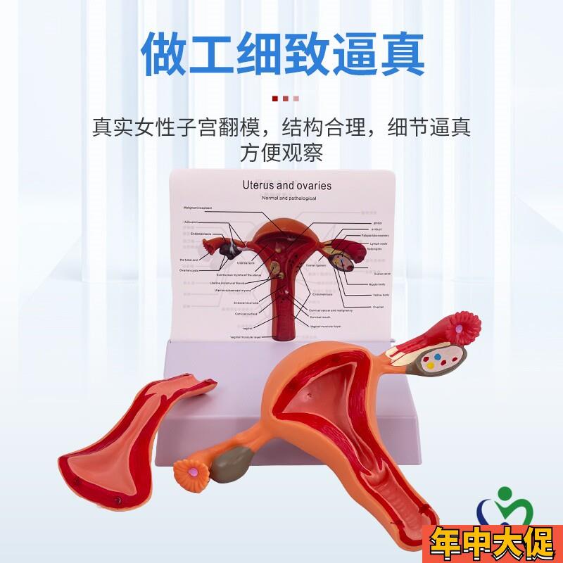 人体子宫模型女性生殖模型阴道卵巢模型教学模具病理变化科学教具