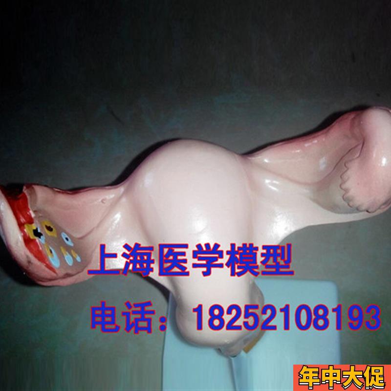 高级子宫放大模型 女性生殖系统解剖模型/人体模型/美院专用