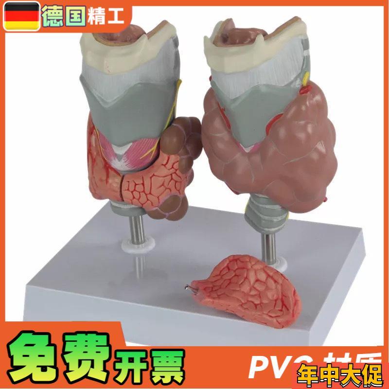 德国】甲状腺病理喉头医学解剖模型甲亢甲低甲jian内分泌系统内科