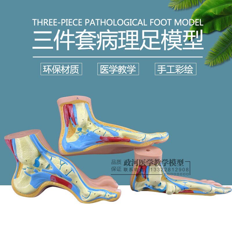 足解剖模型扁平足模型弓形足模型足解剖模型P 型病理足模型包邮