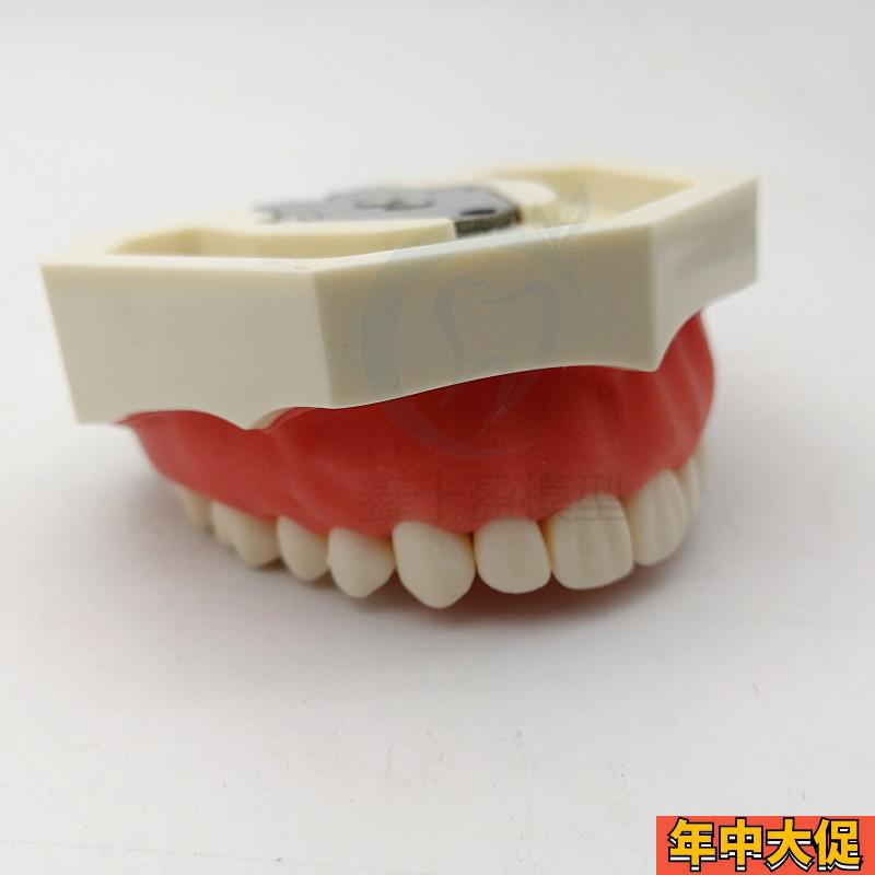 牙科可拆卸牙齿模型 上颌半口备牙模型 下颌半口备牙模型 包邮