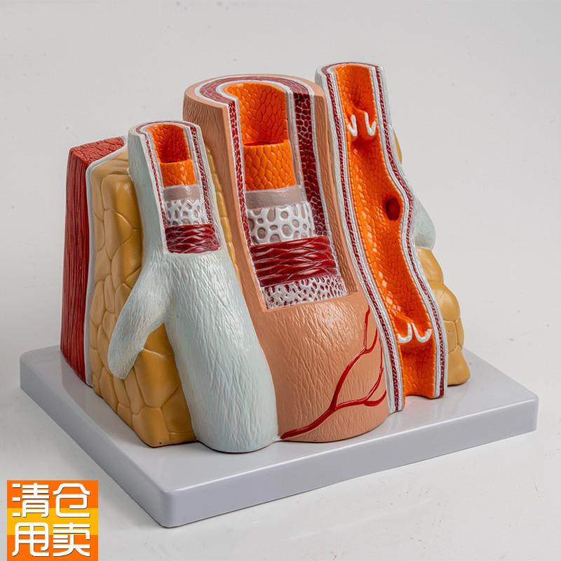 人体血管模型动脉管结构静脉瓣血液循F环系统冠状粥样脂肪沉积阻