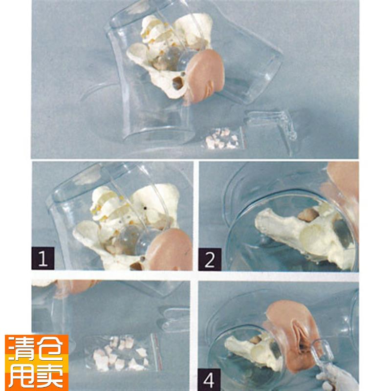高级透明女性导尿模型导尿术技能操作训K练模型插尿管医学用模型