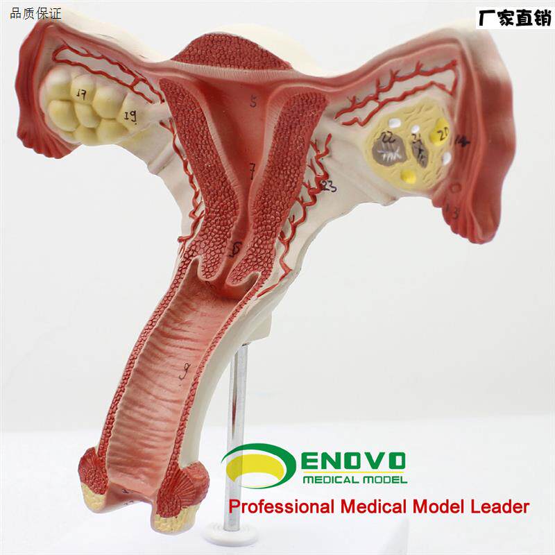 颐诺正品人体医用女性子宫模型卵巢H生殖结构解剖模型妇科妇产科