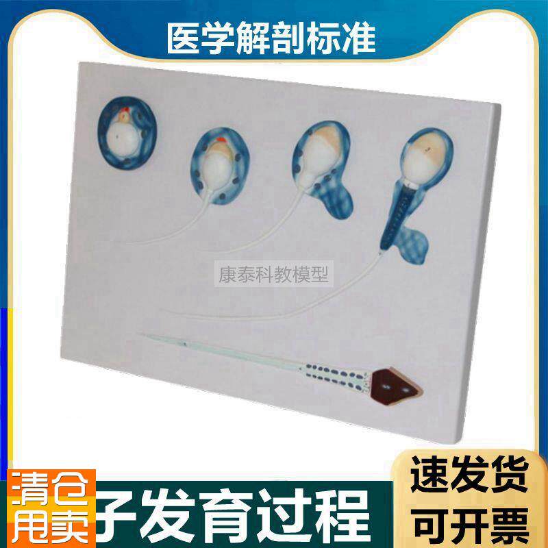 精子模型男性生殖精子生长发育过程睾丸解剖放大输精管男科医患