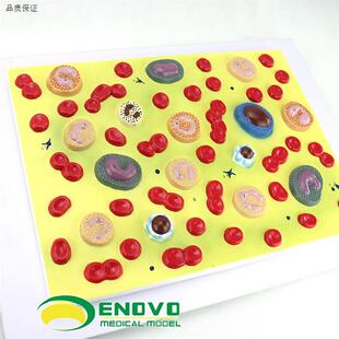 ENOVO颐诺医学人体血U细胞放大模型血液病学内科病理生理教学模型