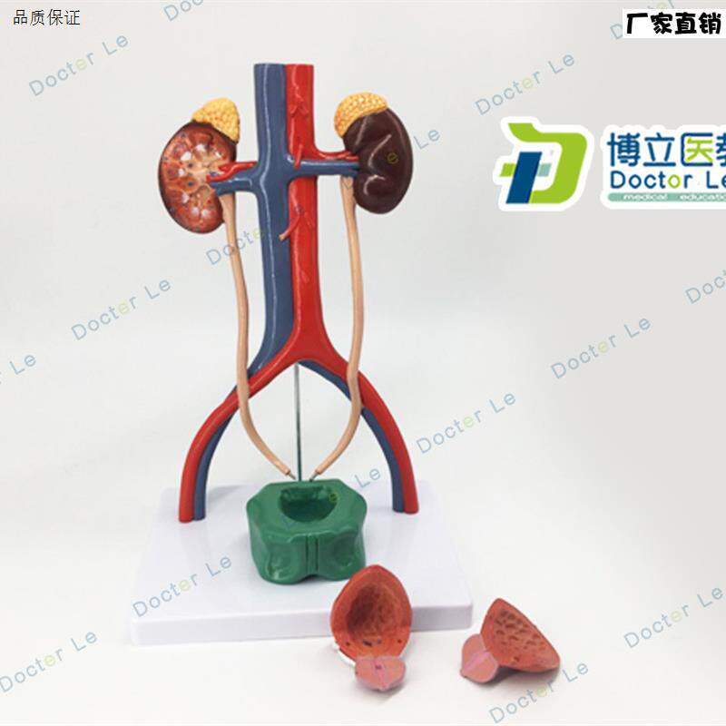 人体泌尿系统模型肾输尿管膀胱尿道解剖模型医S学泌尿科泌尿模型