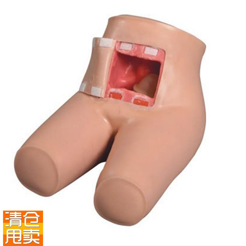 高级辅助排便和灌肠练习模型肛门检查模型灌肠X护理练习模型