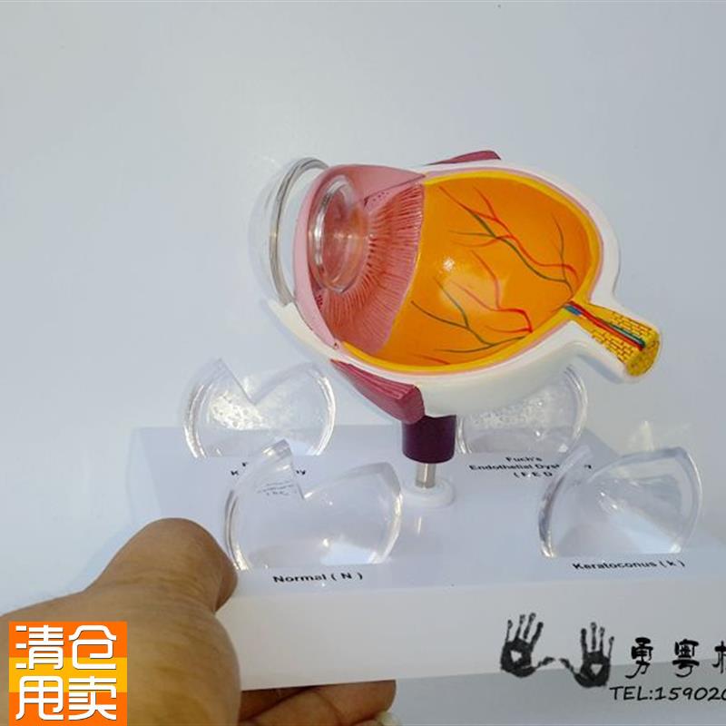眼球疾病眼睛解剖眼球v构造角膜疾病眼球模型眼睛模型