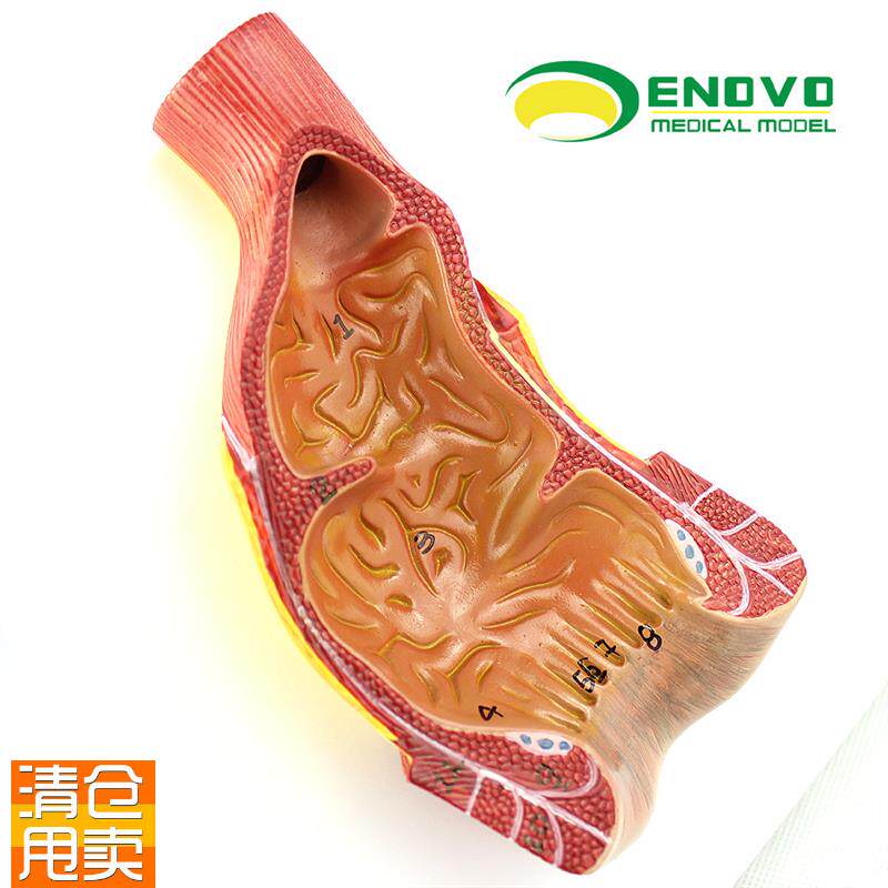 ENOVOc正品医用人体直肠肛管肛门解剖结构模型肛肠科外科消化系统