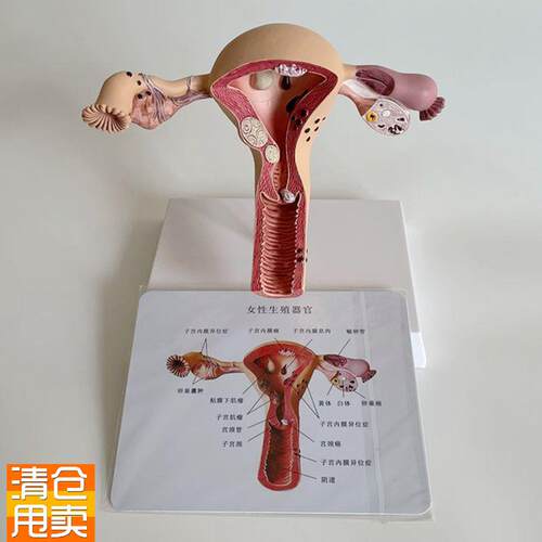 康泰医学子宫模型病理输卵管卵巢妇科生殖医药促销W礼直播跨境热