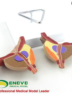 ENOVO前列腺解剖教学模型泌尿科BPH分C区教学器材