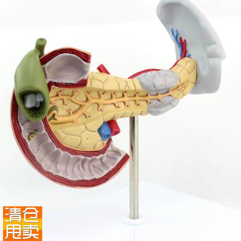 ENOVO颐诺医k学用胰腺十二指肠和胆囊病理模型消化系统消化科模型