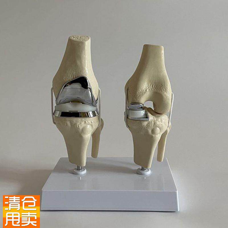 人工膝关节模型膝盖置换仿真假体半月板I软骨胫骨平台髋关节替换