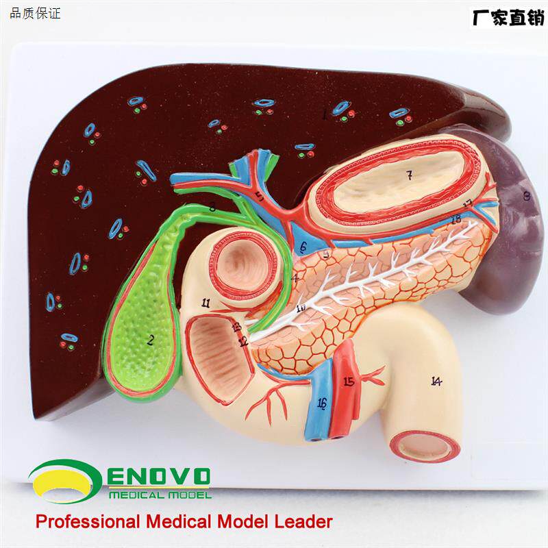 颐诺人体肝胆胰十S二指肠胃结构模型消化科医用Whipple模型
