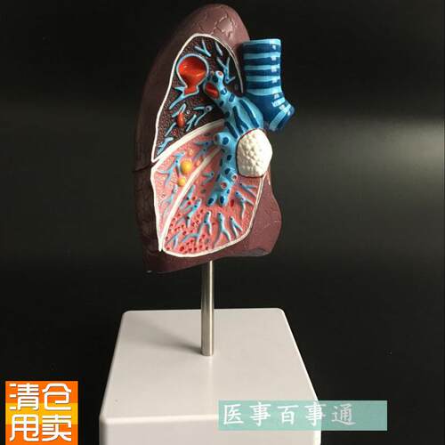 教学仿真病变肺模型病q理肺解剖标本人体解剖内脏解剖仿真医学教