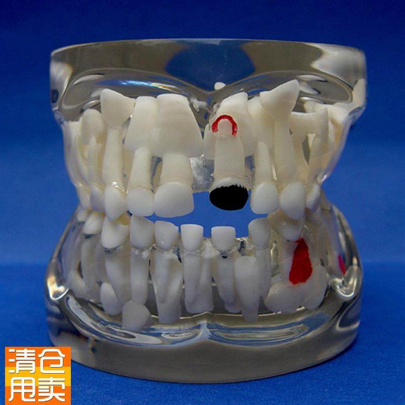 ENOVO正品儿童乳o牙早期病态牙列模型牙齿发育幼儿牙齿护理教学具