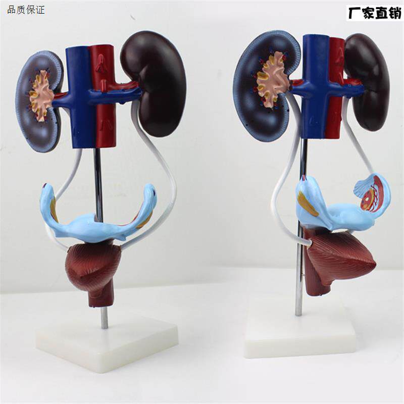 颐诺正品医用女性泌尿N生殖系统模型生殖解剖肾脏子宫膀胱模型