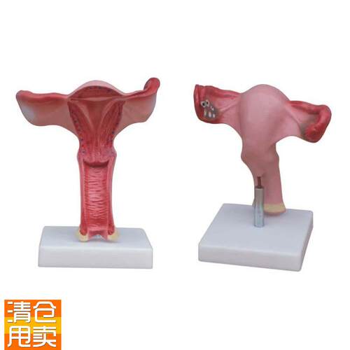 医用人体a女性子宫放大解剖示教模型