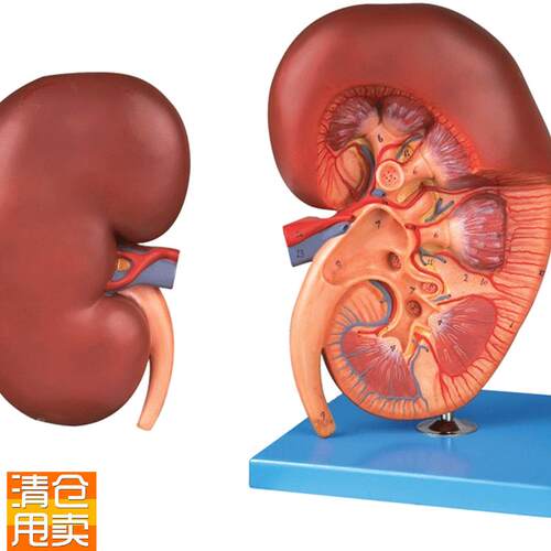肾脏解剖放大模H型A14005