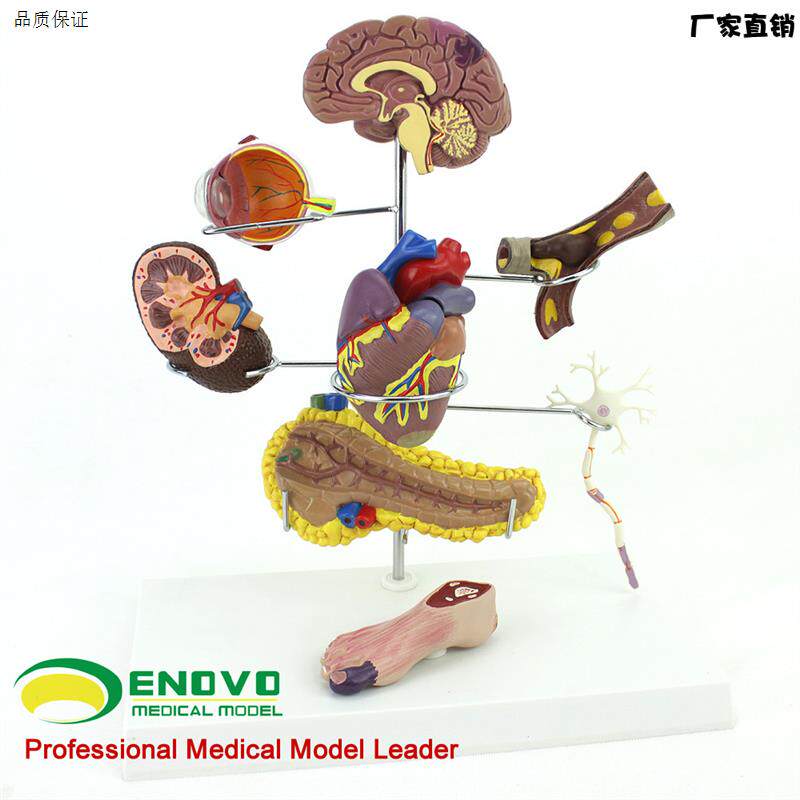 ENOVO颐诺人体医学糖尿病模c型并发症大脑心脏胰腺神经元足内外科